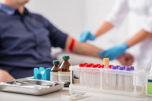 Titers testing