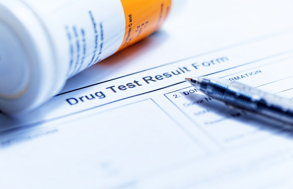 drug test result form