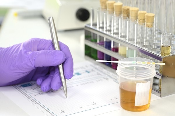 Do antidepressants show up on a drug test
