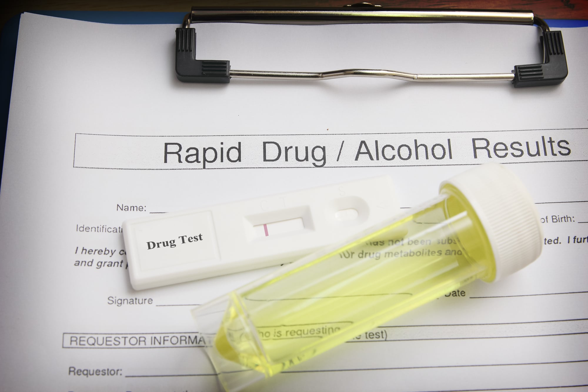 drug screening