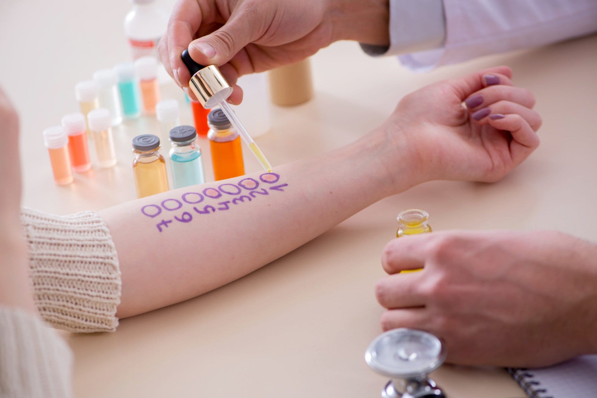 allergy test