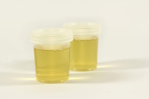 alcohol drug screening