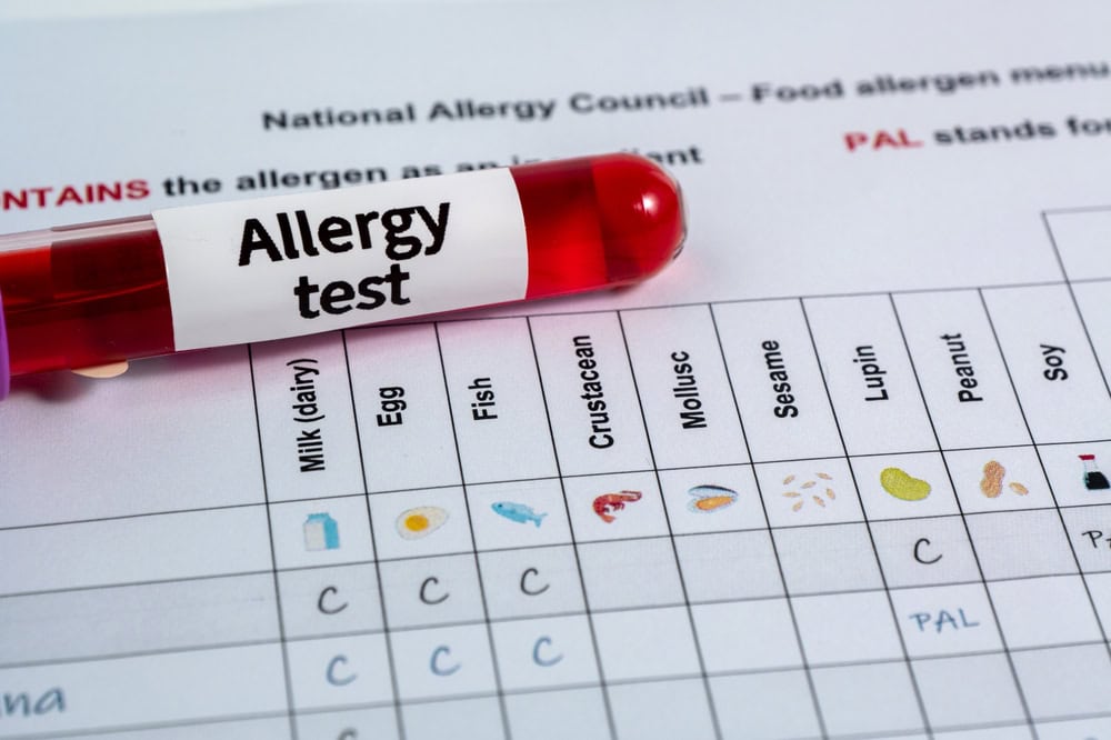 allergy testing